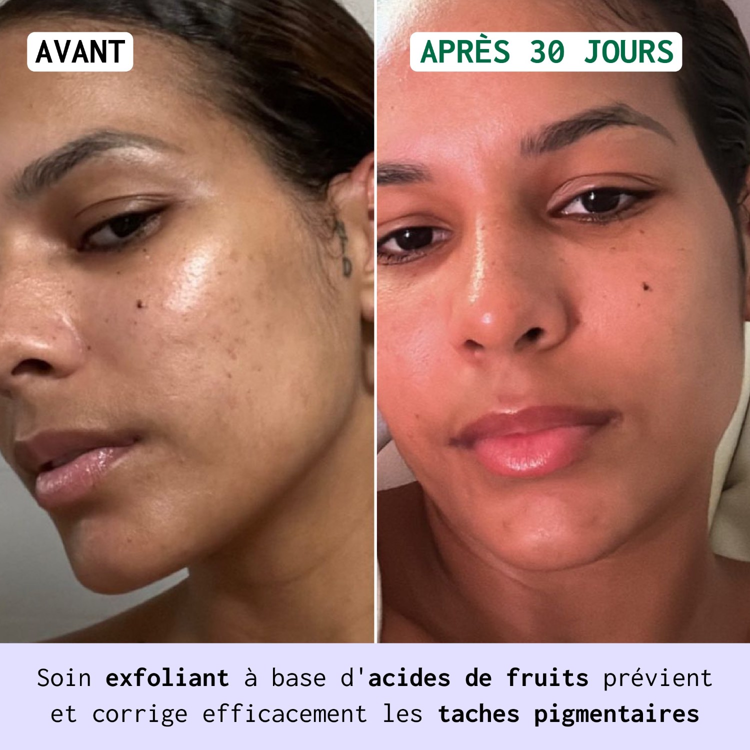 Nubiance Sérum anti-taches HRB-3
