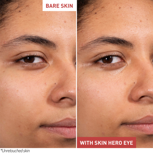 Skin Hero Eye