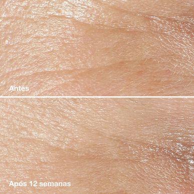 Clinique Smart Clinical Repair Wrinkle Correcting Cream Ikääntymistä ehkäisevä kosteusvoide peptideillä 75 ml