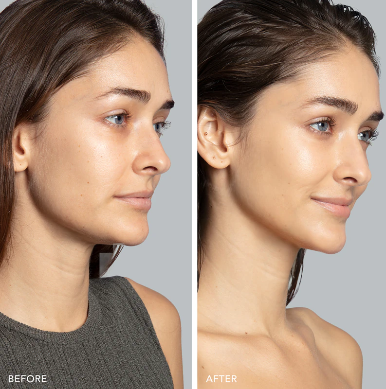 Aparelho de Tonificação Facial por Microcorrente FOREO BEAR™ 2
