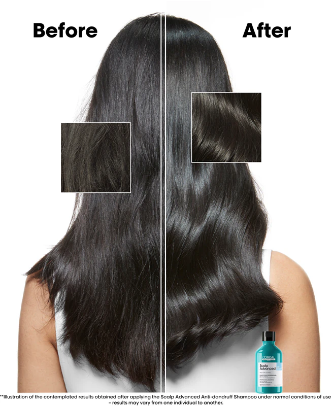 L'Oréal Professionnel Serie Expert Scalp Geavanceerde anti-roosshampoo
