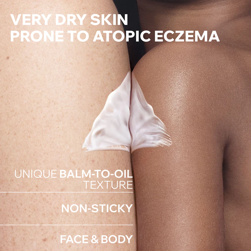 Bálsamo calmante anti-coceira Uriage Xemose C8+ Lipid-Replenishing para pele seca e atópica.