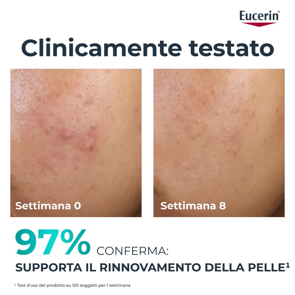 Dermopure Trattamento Rinnovatore - Siero viso antimperfezioni, Tratt.viso 24 ore antimperfezioni