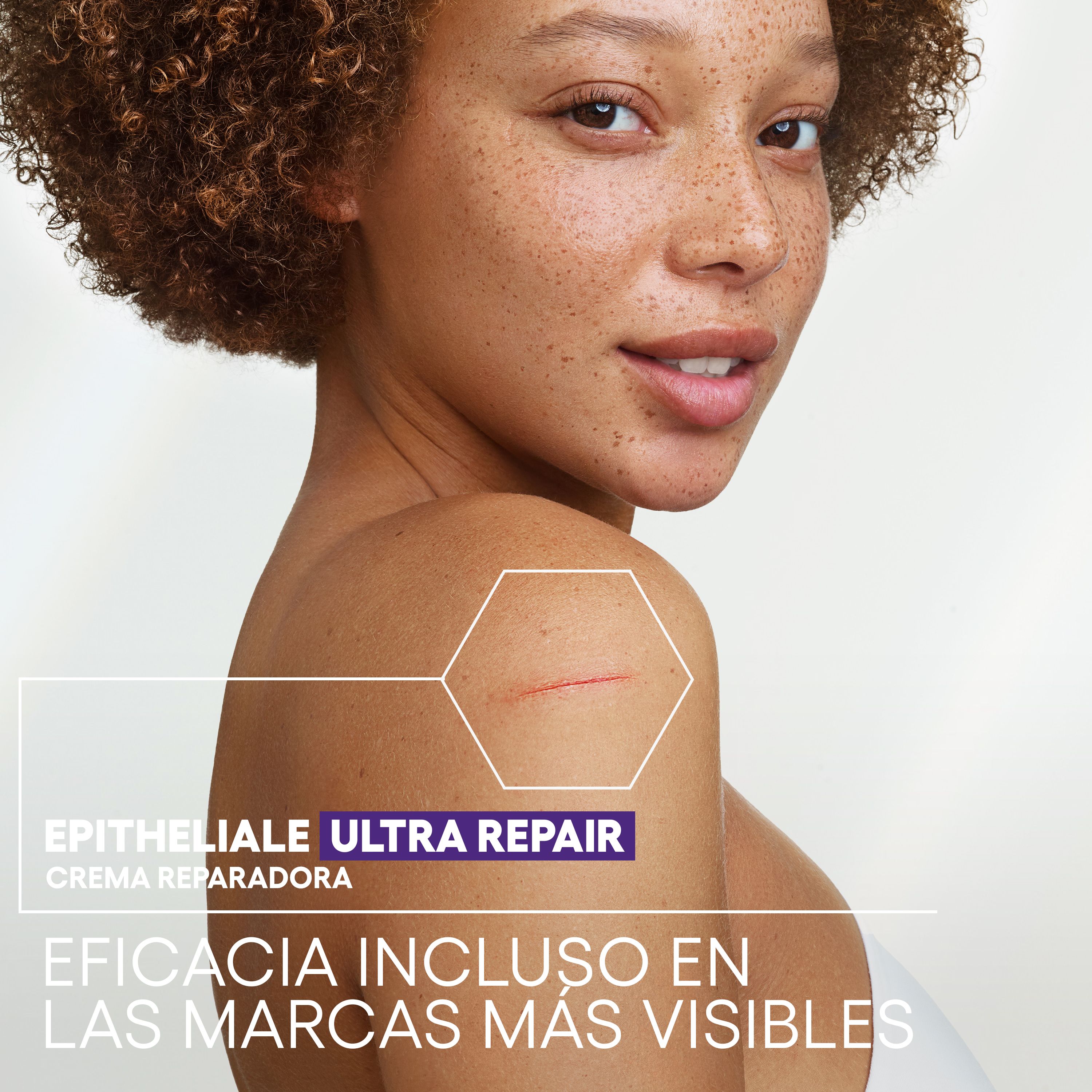 Epitheliale AH Ultra umirujuća krema za obnovu Ljekarnički tretmani