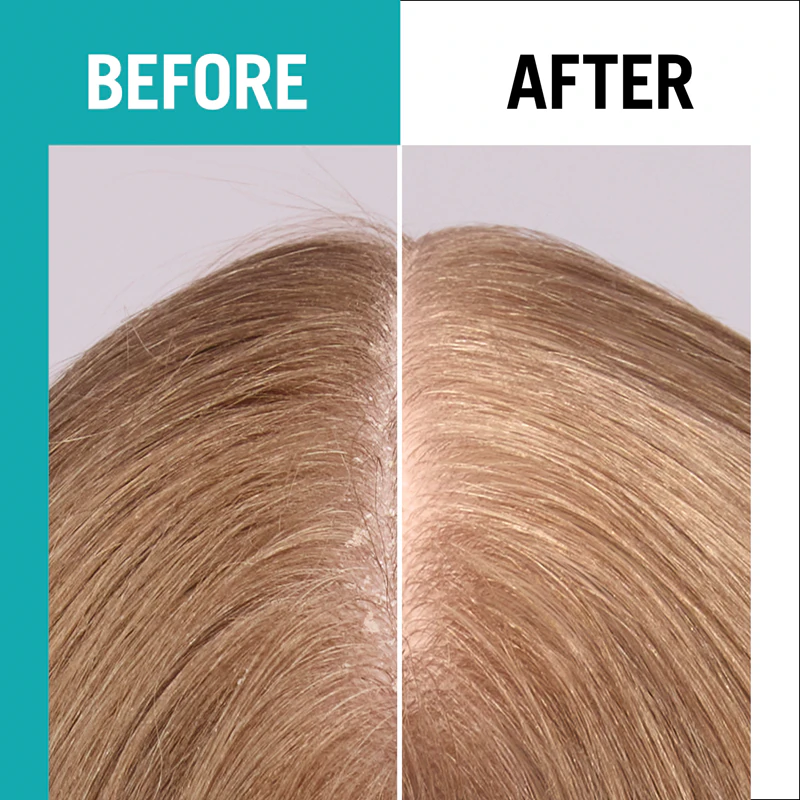 Schwarzkopf Gliss Scalp Balance zonnebrandspray voor de hoofdhuid