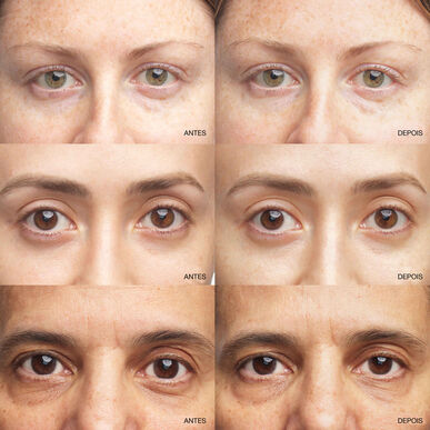 Clinique All About Eyes Brightening Serum Concentrate Øyekonturserum 10 ml 10 ml