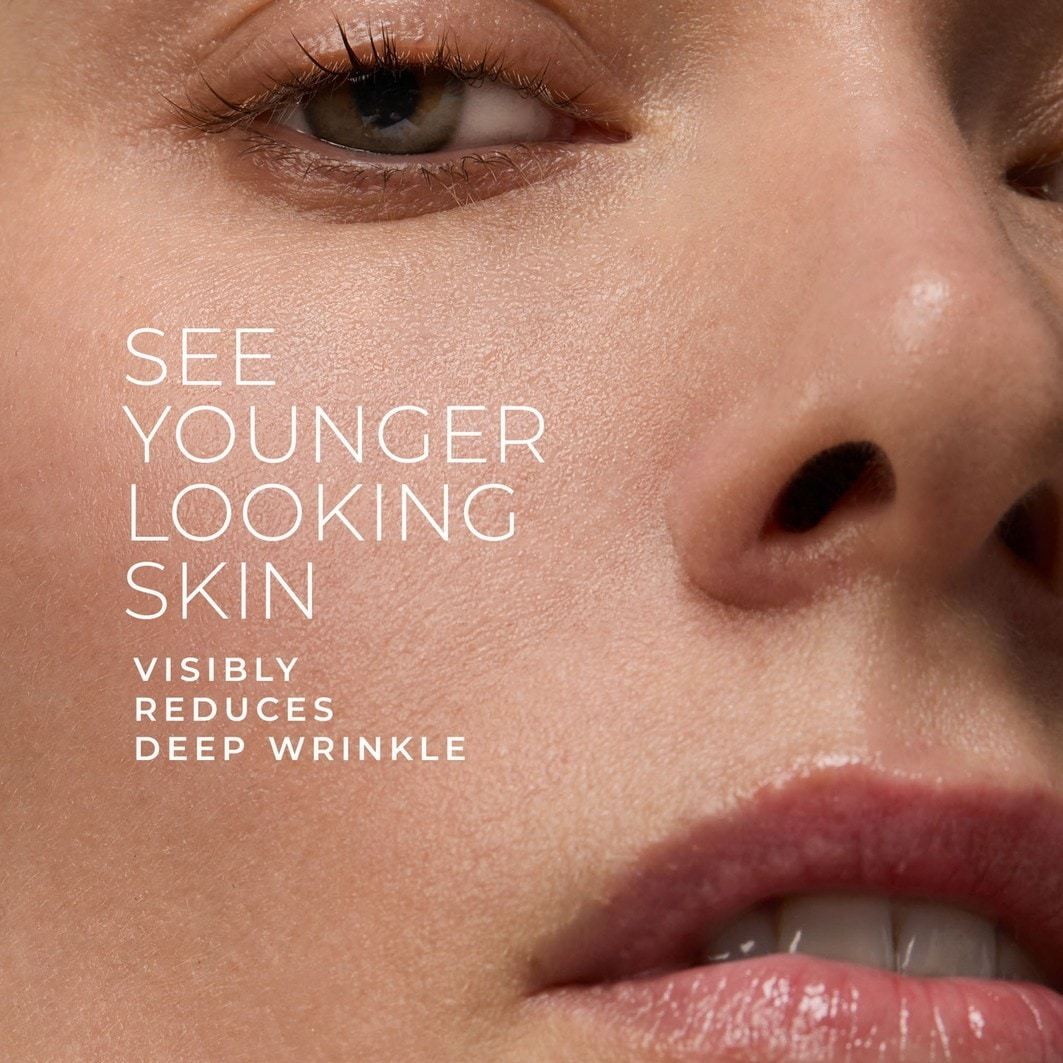 RoC Serum protiv starenja Retinol Correxion Serum za korekciju bora - 30 ml