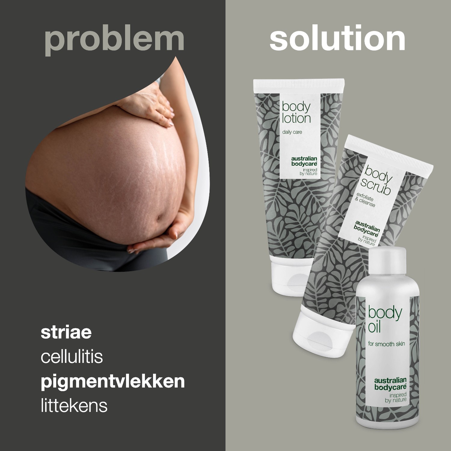 Set za njegu strija Australian Bodycare – 1 komad