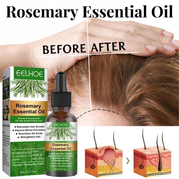 soin cheveux romarin huile essentielle pour prévenir casse cheveux croissance cheveux huile essentielle pour