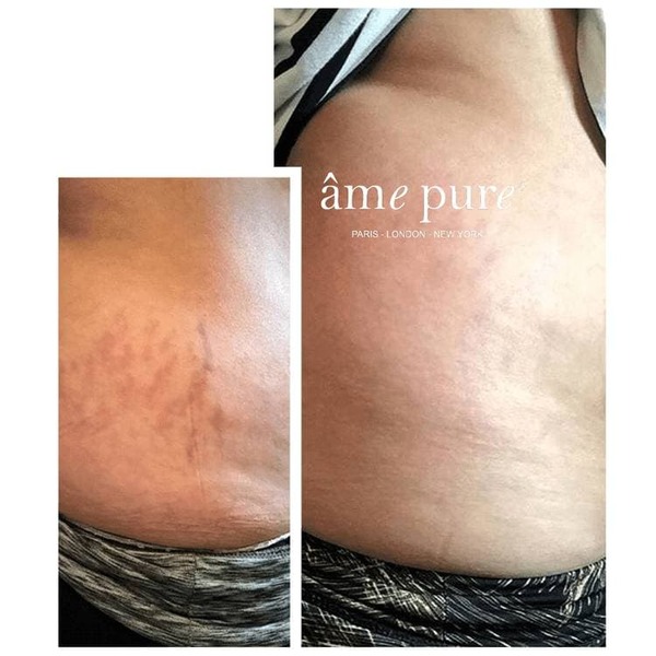 âme pure Body Basic