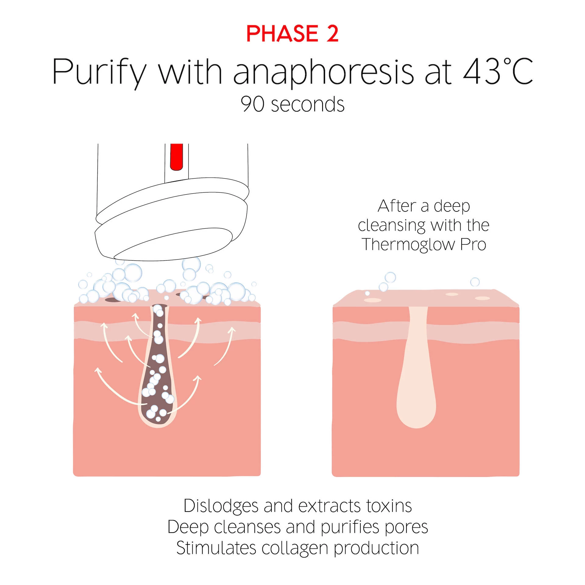 A ThermoGlow Pro - Dr. LEVY Svájc
