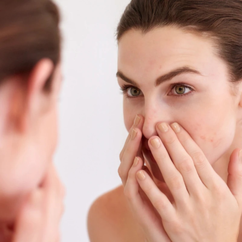 Avène Cleanance micelarna voda za mastno in mešano kožo