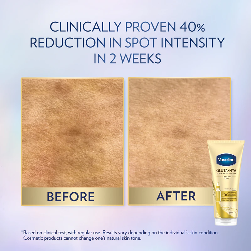 Telové sérum Vaseline Gluta-Hya Flawless Tone