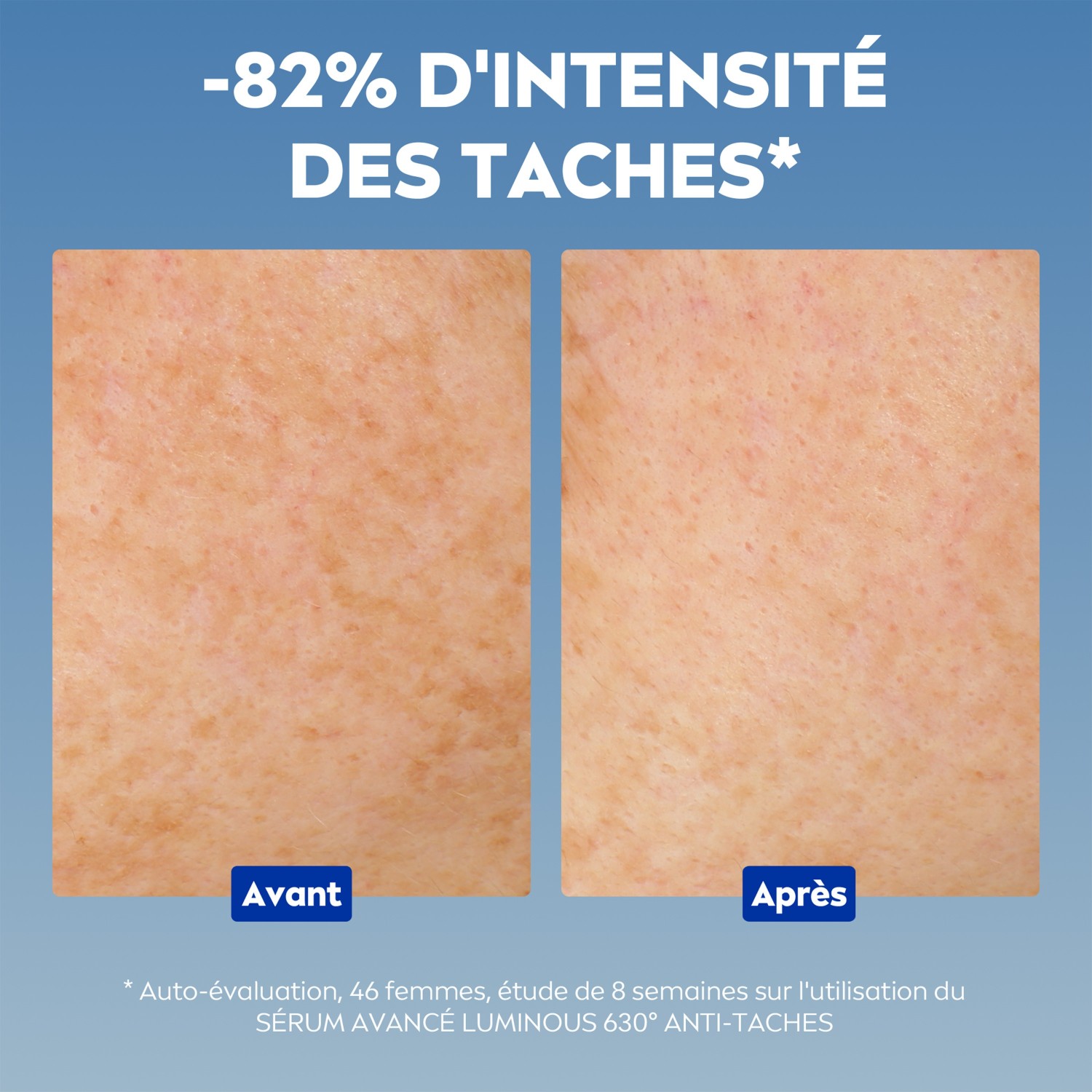 NIVEA Sérum Soin visage Correcteur Anti-taches et Anti-âge