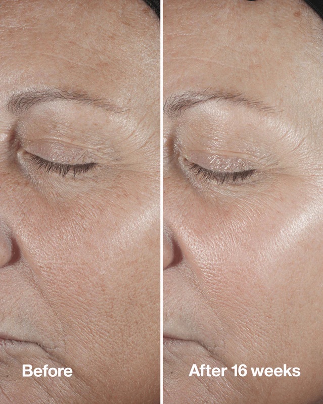 Clinique Smart Clinical™ Repair serum za korekcijo gub