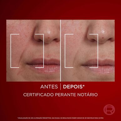 L'Oréal Paris Revitalift Laser X3 Anti-Wrinkle Dagkräm, Anti-Aging Återfuktande Ansiktskräm, 50 ml