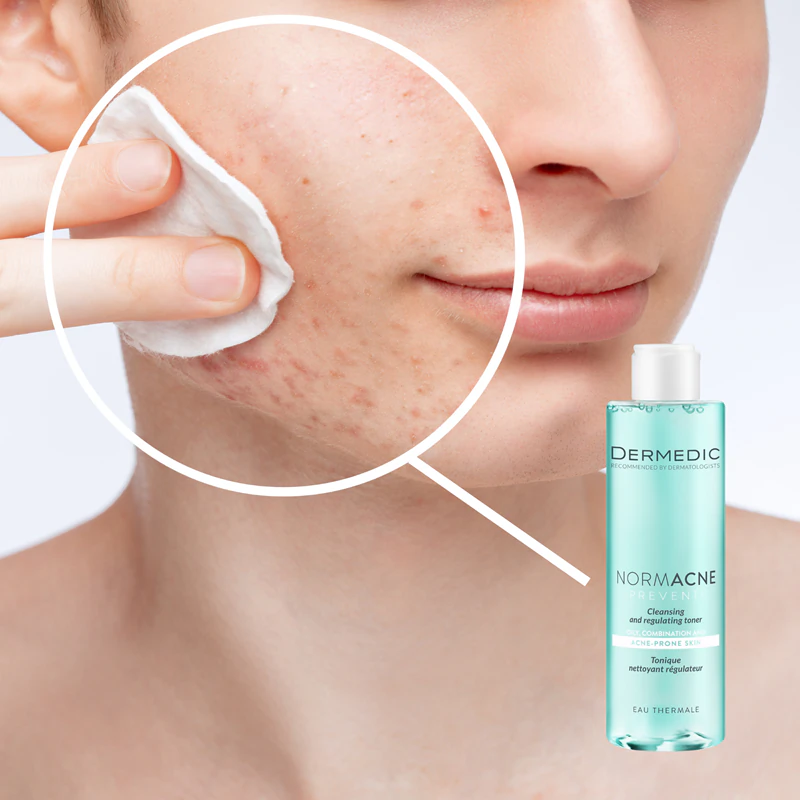 Tônico de limpeza e regulação Dermedic Normacne Preventi