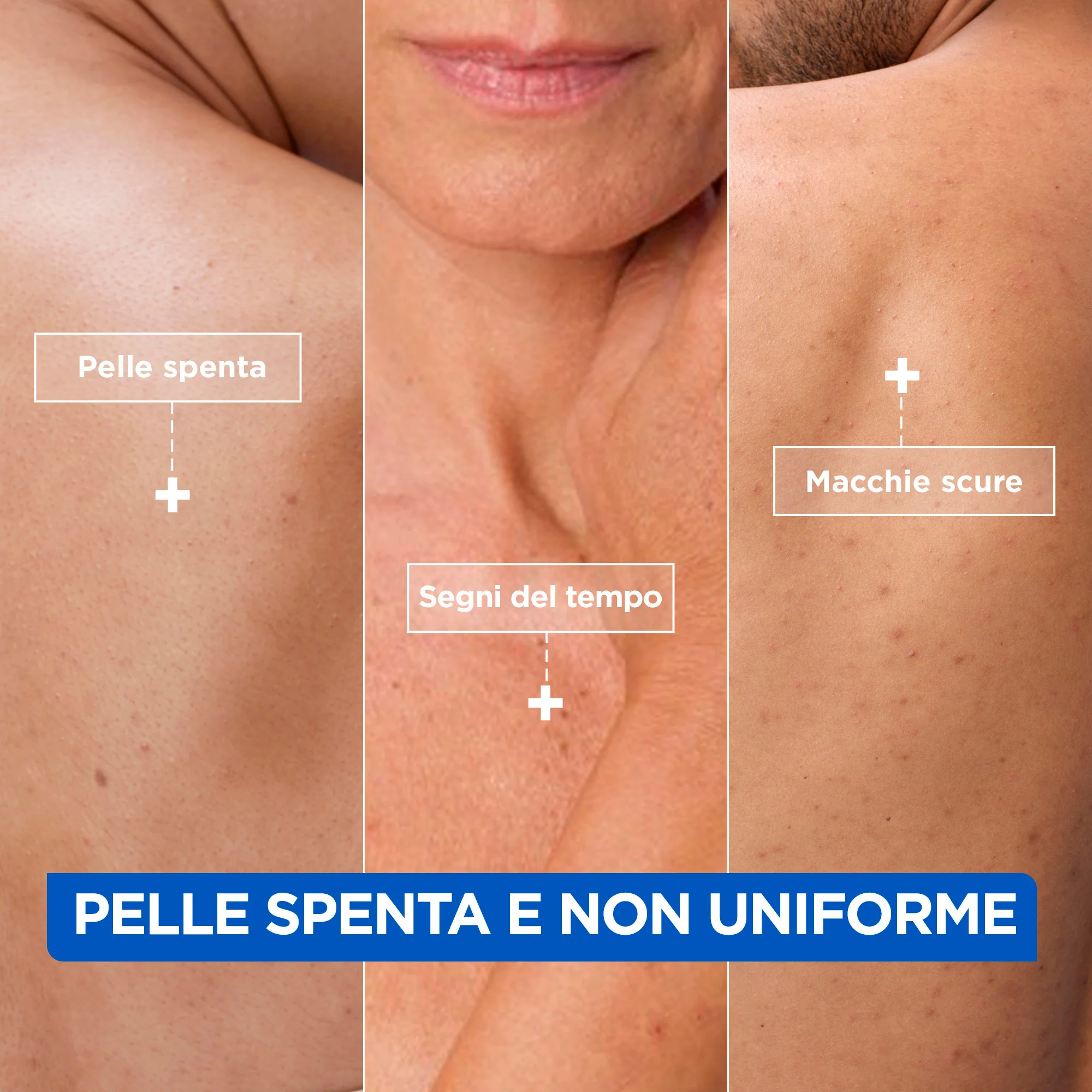 Corpo Niacinamide Bright - Moisturizing - Crema Corpo, Crema corpo illuminante