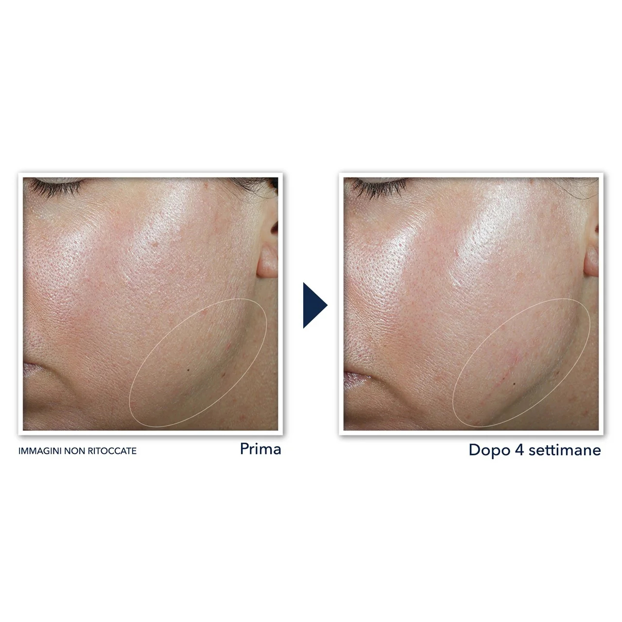 Derm Correxion Crema Viso - Tratt.viso 24 ore antirughe, Tratt.viso 24 ore antimperfezioni, Tratt.viso 24 ore effetto globale
