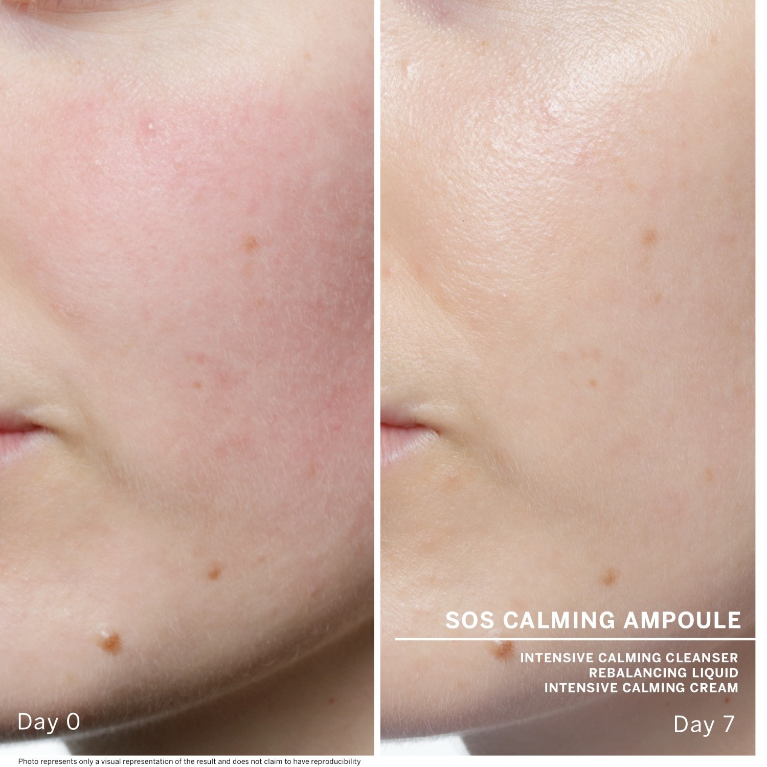 BABOR Ampoule Serum Ampulinė koncentratas SOS Calming - 14 ml