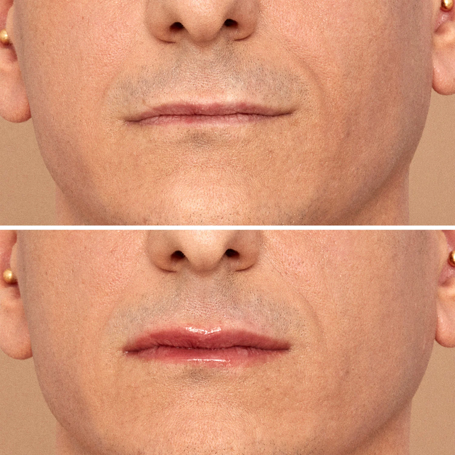 Labbra Viper Lip Plumper - Volumizzante Labbra