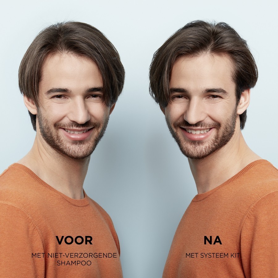 Nioxin matu kopšanas sistēma 2 dabīgiem matiem – progresējošas matu izkrišanas, galvas ādas un matu ārstēšana – 100 ml
