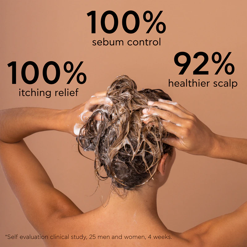 Apivita Anti-roosshampoo voor vet haar