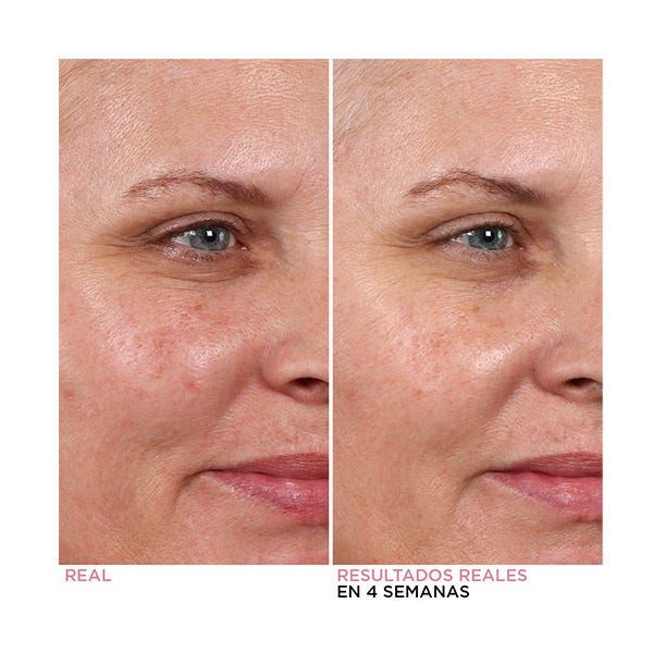 Hello Results Baby-Smooth glykolový peeling + pečující olej | 30 ml