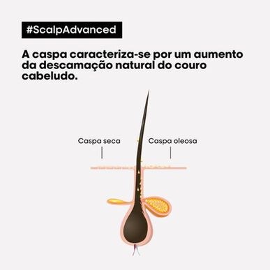 L'Oréal Professionnel Serie Expert Scalp Advanced Pelliculaire Schampo Lugnande torr och fet hårbotten Anti-mjällschampo 300 ml 300 ml