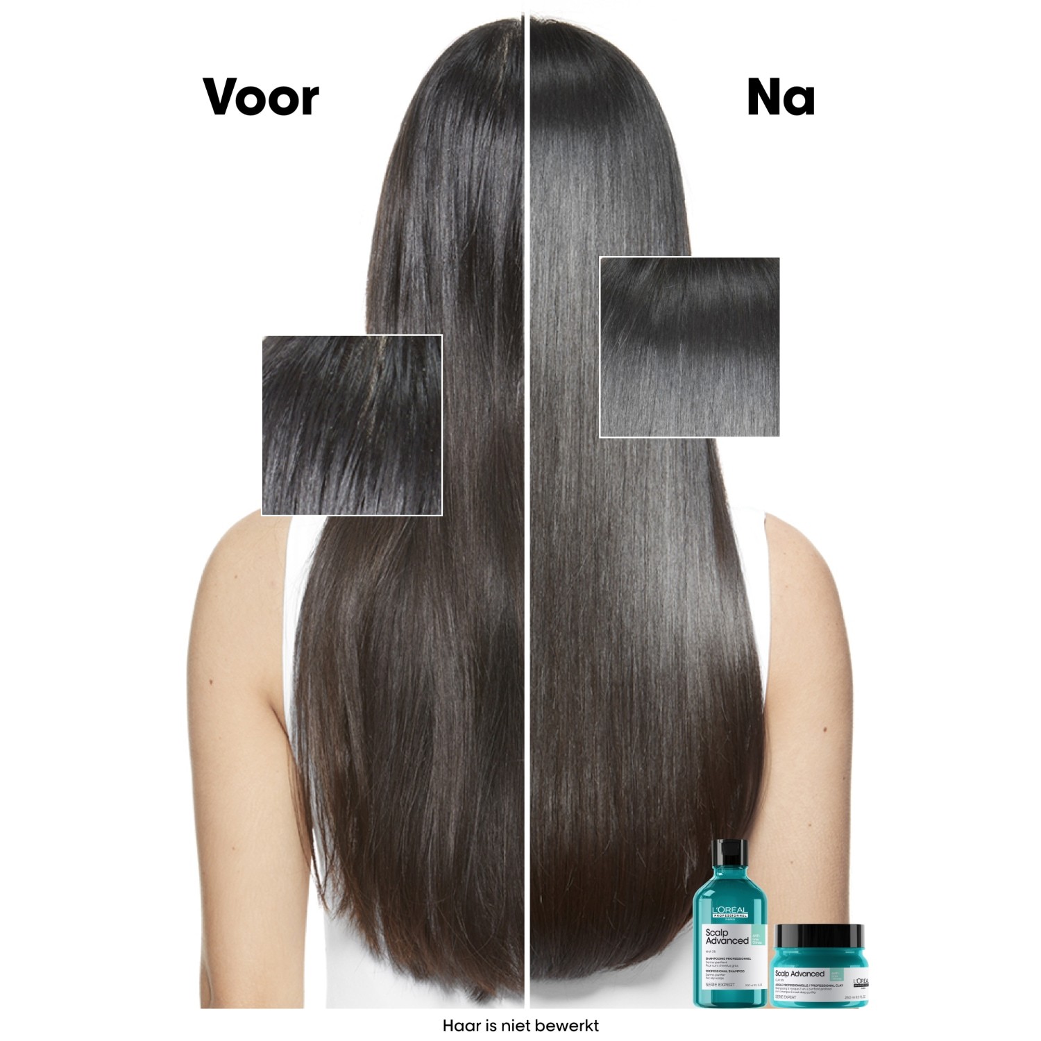 L'Oréal Professionnel šampon za kosu Skalp Advanced Anti-Filiness Dermo-Cleanser - 300 ml