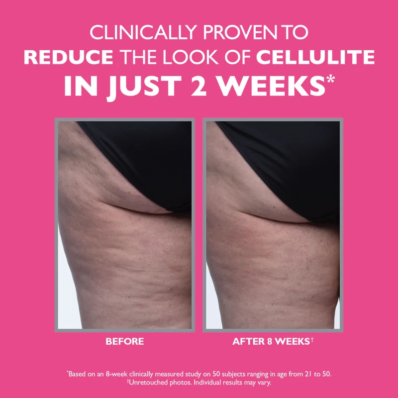 Peter Thomas Roth FIRMx Tight & Toned krema za učvrstitev telesa proti celulitu