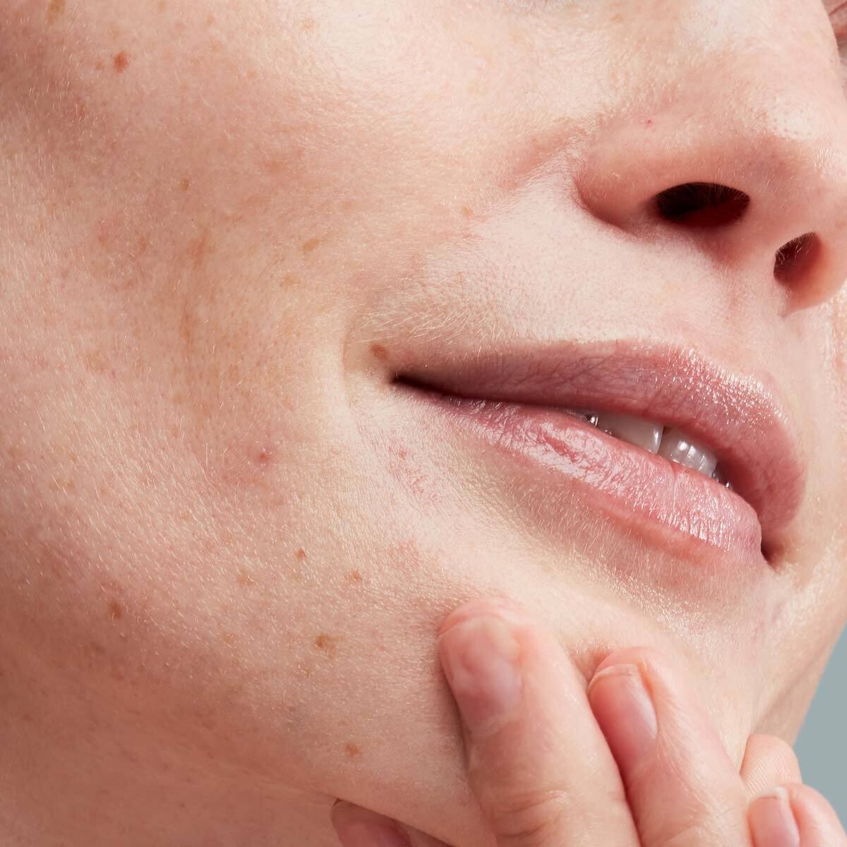 Pai Skincare Instant umirujući hidratantni serum - 30 ml