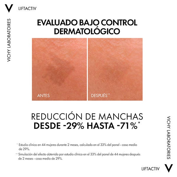 Liftactiv Specialist B3 szérum| 30 ml