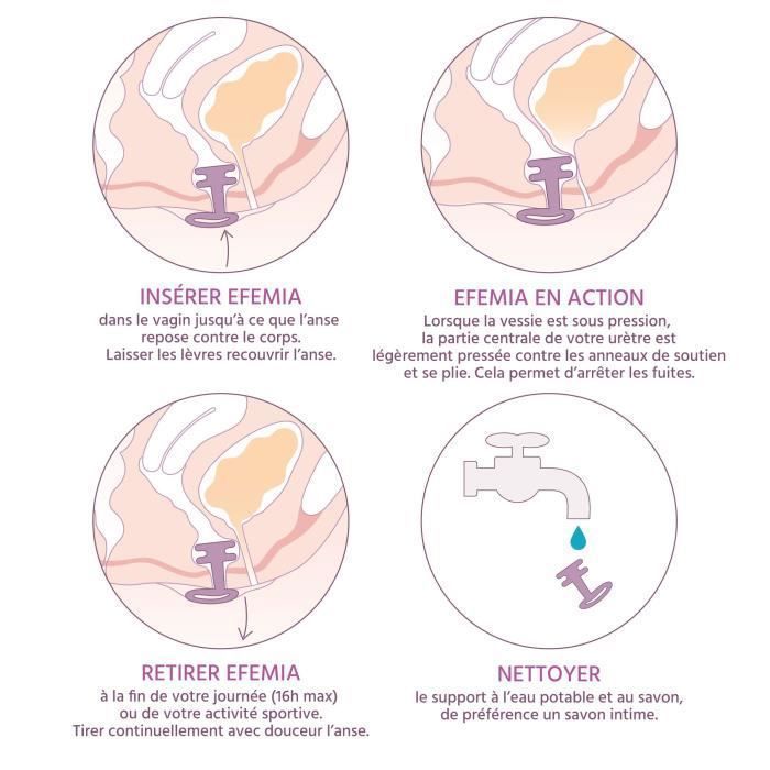 Pessaire - Efemia - Start Set - Taille Unique - Incontinence Urinaire - Femme