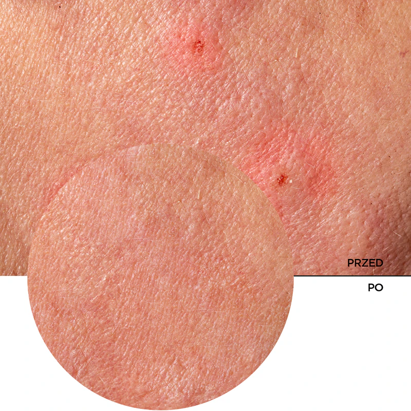 Revox B77 JUST Provitamine B5 en Centella Verzachtende Hydraterende Balsem