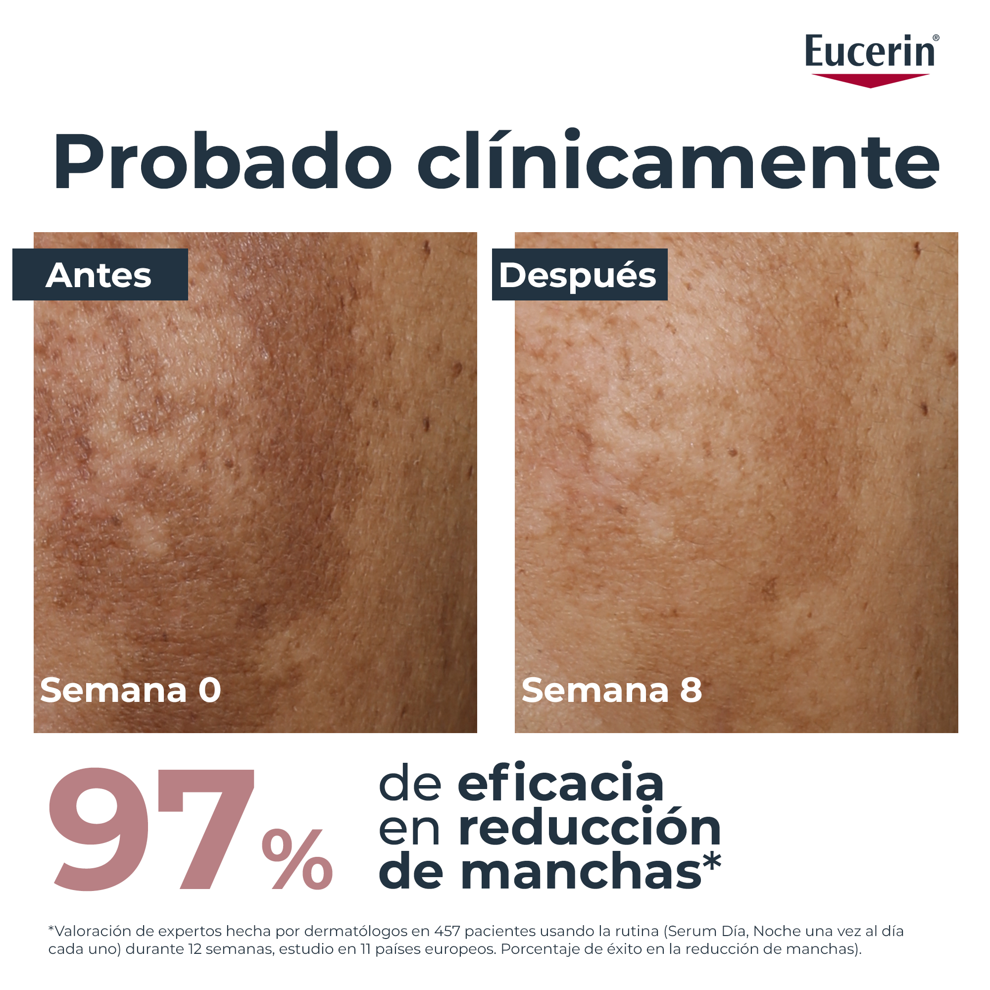 Dnevna krema proti pigmentnim madežem SPF 30 Kreme proti temnim madežem