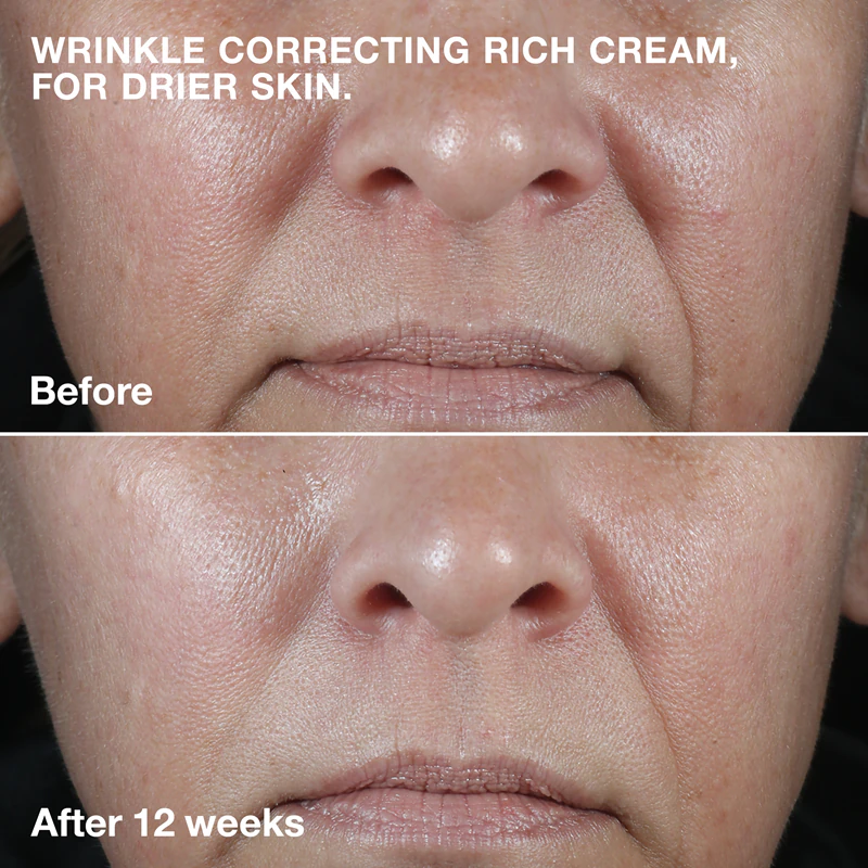 Clinique Smart Clinical™ Repair Creme Corretor de Rugas creme nutritivo antirrugas