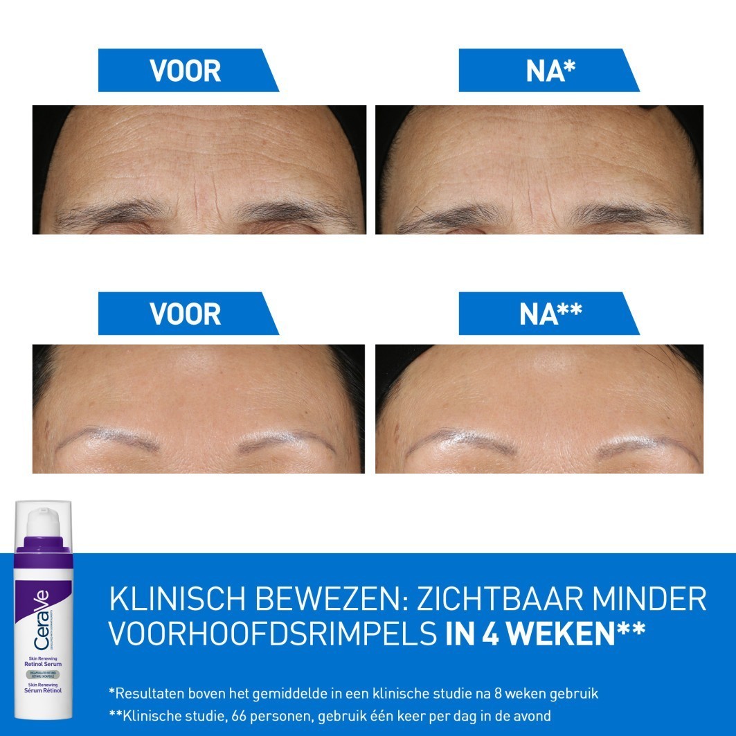 CeraVe sérum proti starnutiu pleti s retinolom - 30 ml