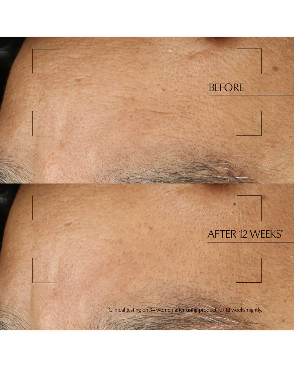 ESTÉE LAUDER Advanced Night Repair Νυχτερινή Θεραπεία Εντατική νυχτερινή φροντίδα με υαλουρονικό οξύ