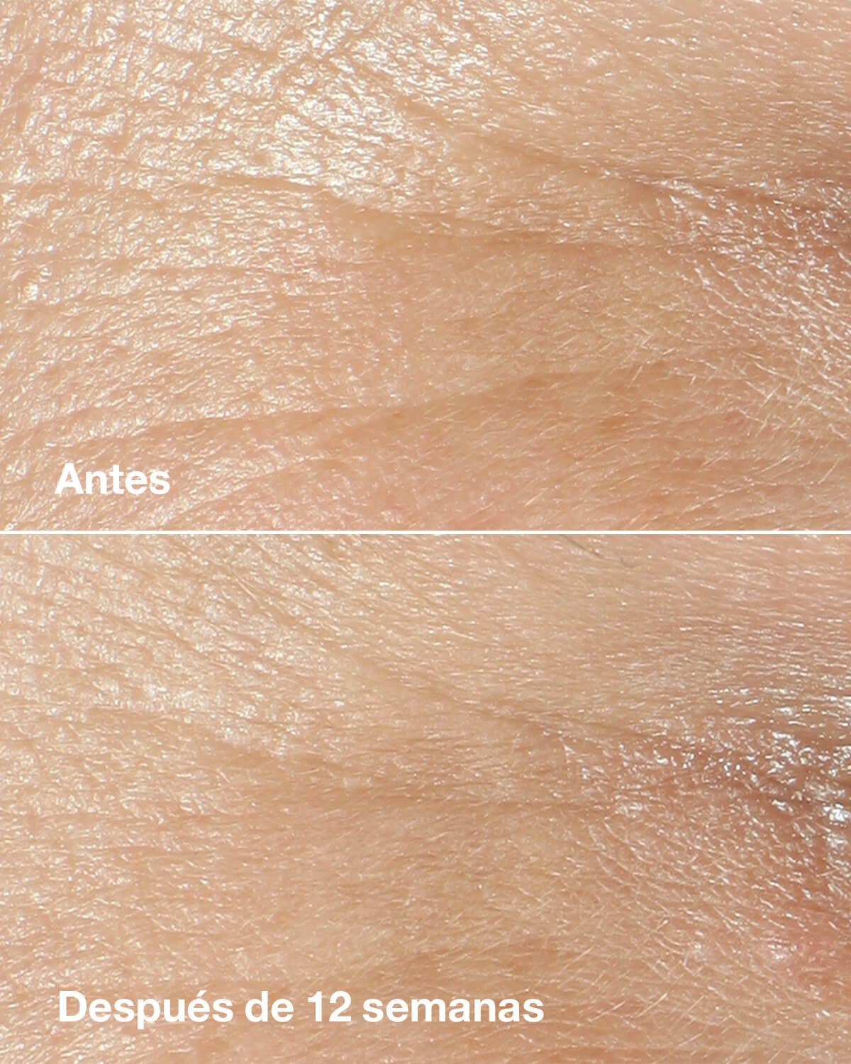Smart Clinical Repair krém na korekciu vrások Luxusný hydratačný a vyživujúci krém