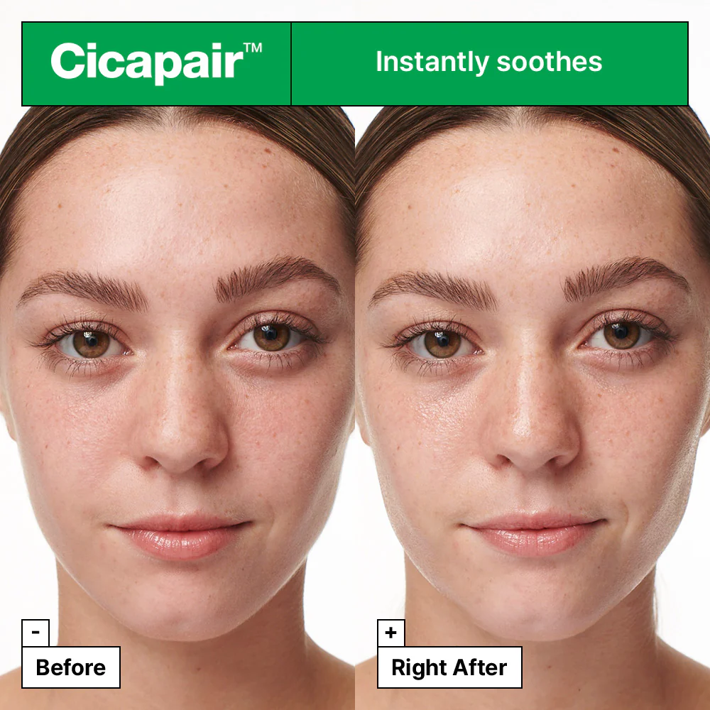 Cicapair™ Intensive Soothing Repair Serum - Siero viso  lenitivo