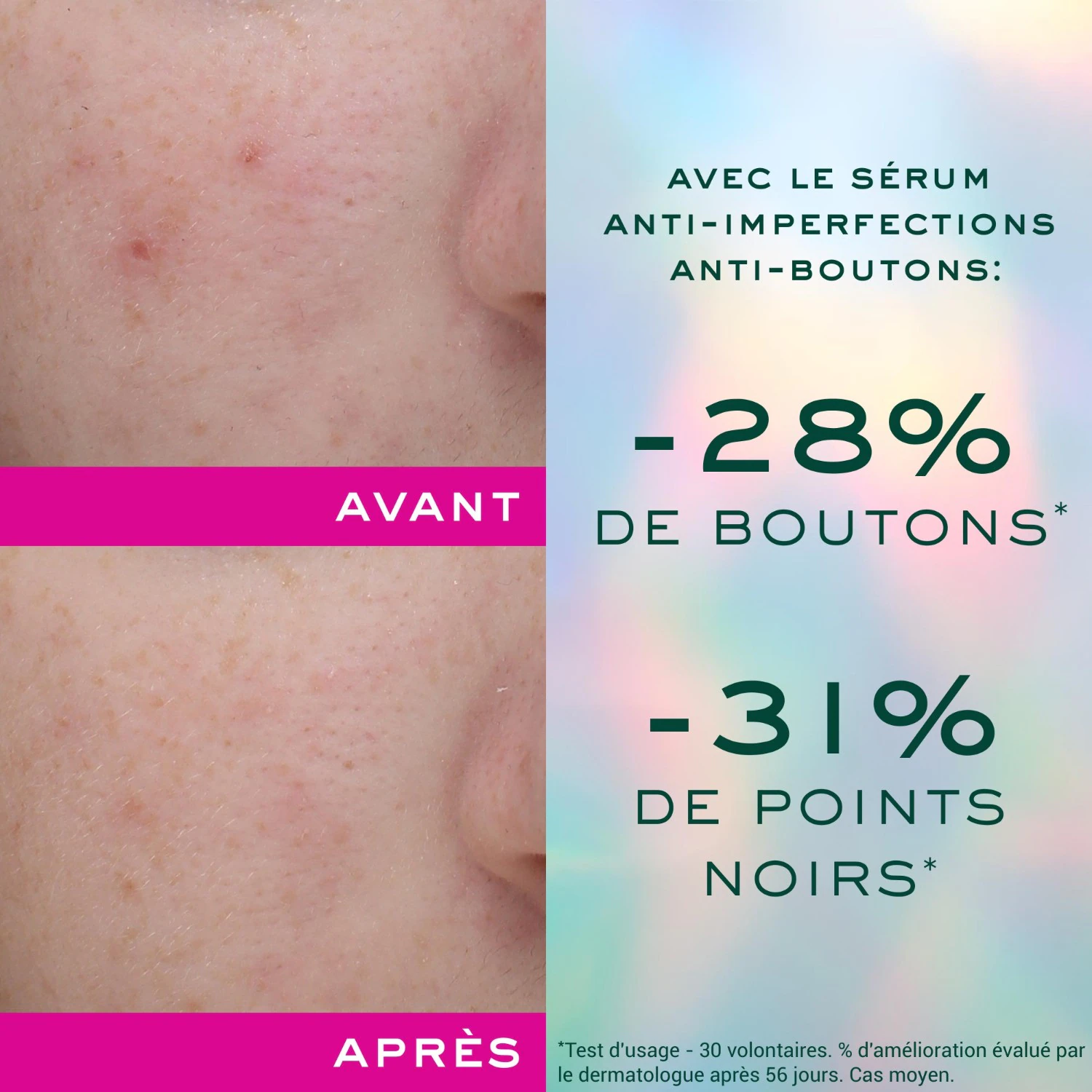 NUXE Sérum Anti-Imperfections Anti-Boutons