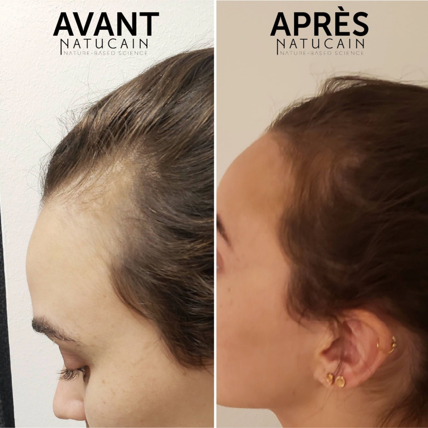 Natucain Natucain Hair Activator
