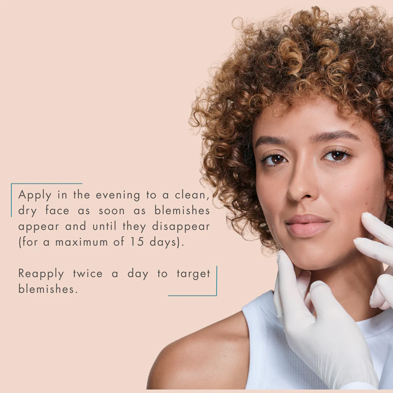 Avène Cleanance Creme Peeling Intensivo para Pele com Tendência à Acne