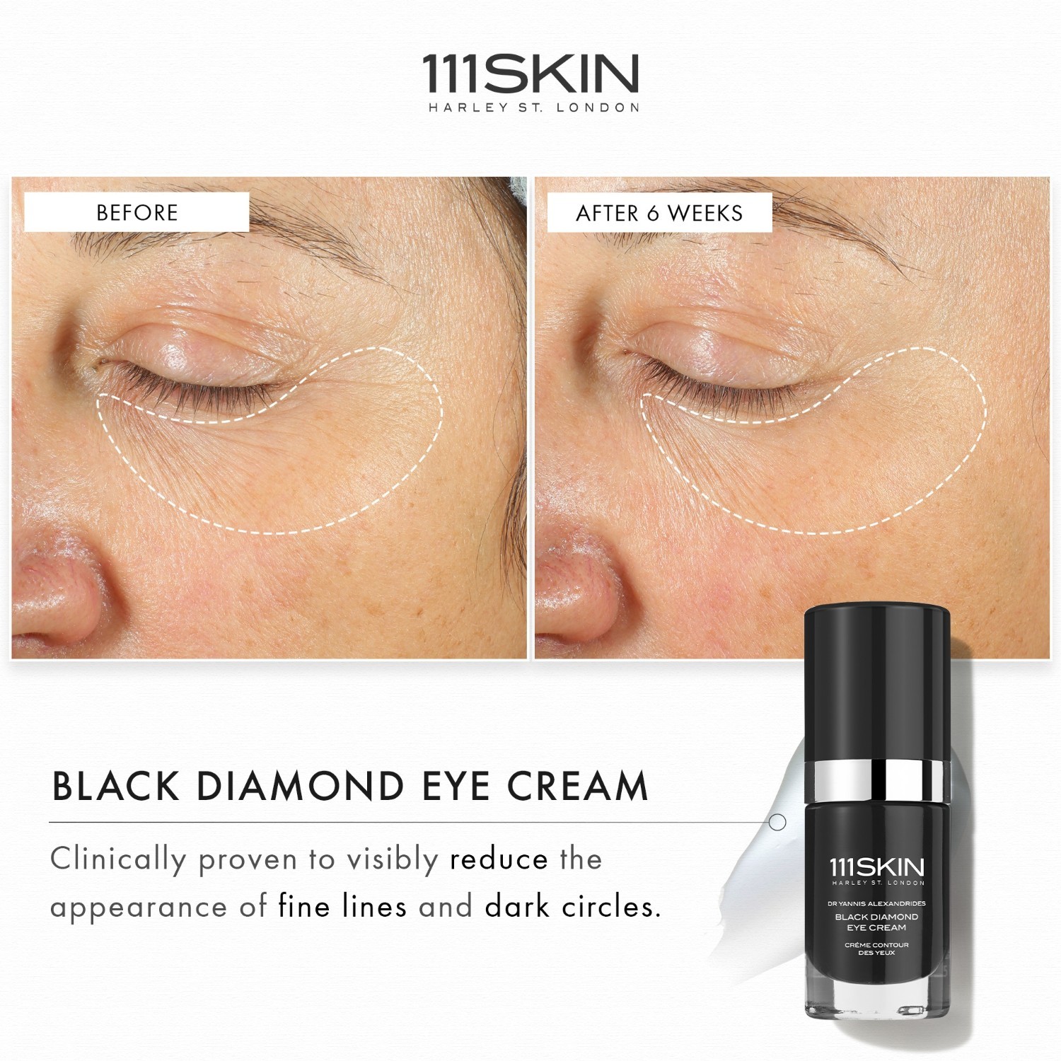 111Skin krema za područje oko očiju s crnim dijamantom - 15 ml